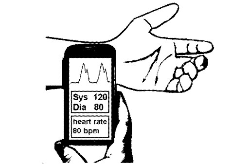 Laser Speckle Interferometric health monitor