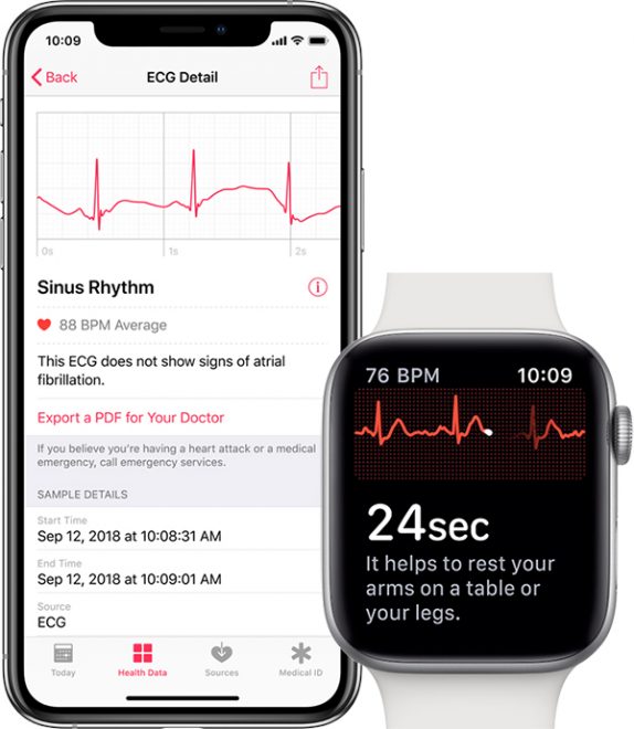 Apple watch serie 5 ecg hot sale